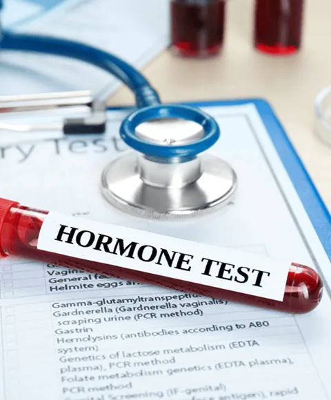 A test-tube of hormobe test